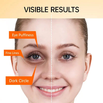 Eye Cream Anti Dark Circles Eye Bag